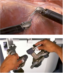 Robot chirurgical Da Vinci