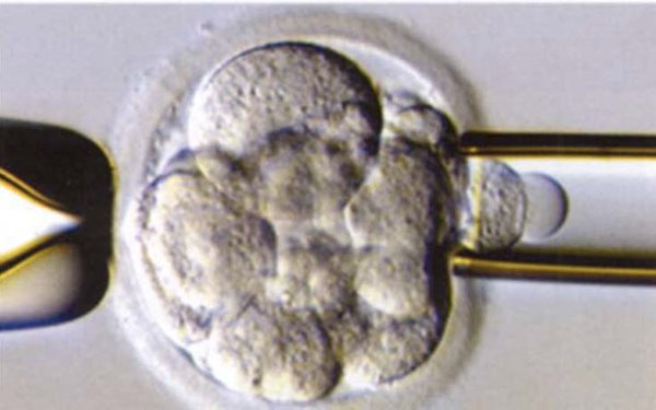 Gene_2.jpg