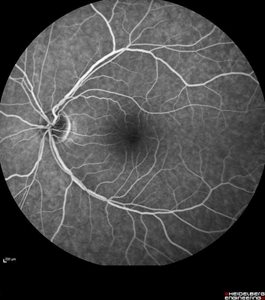 retine-medicale-im5.jpg